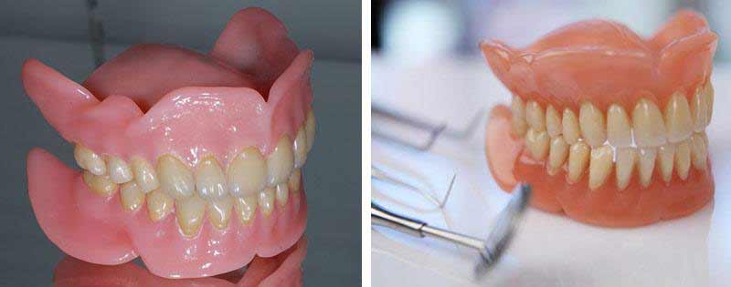 Guide du stockage des prothèses dentaires